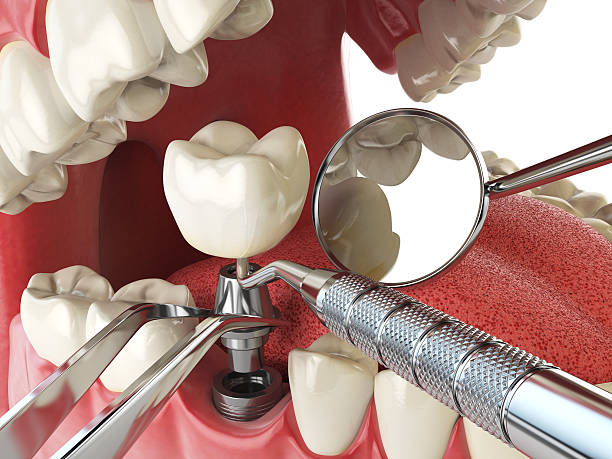 Best After-Hours Dental Trauma Care in Malmstrom Af, MT